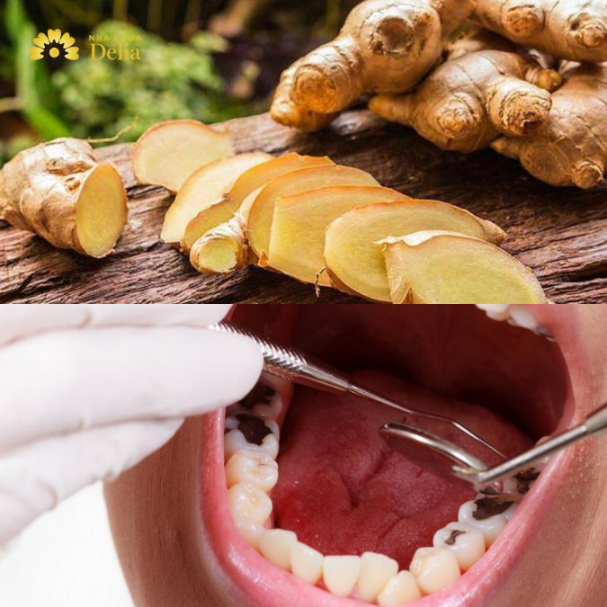 Nhai gừng tươi có thể hỗ trợ giảm đau răng ngay lập tức