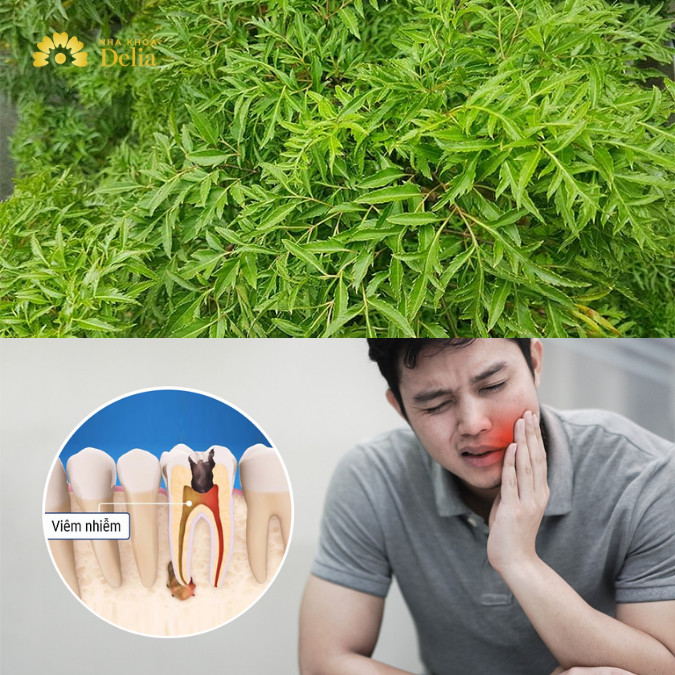 Cây đinh lăng chữa đau răng hiệu quả do có hoạt chất kháng viêm trong lá đinh lăng