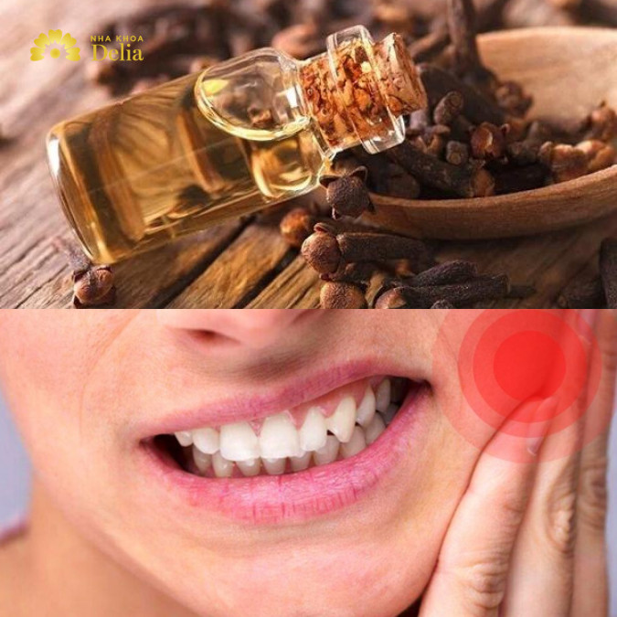 Nhiều người chỉ tin dùng dầu đinh hương để hỗ trợ giảm đau răng