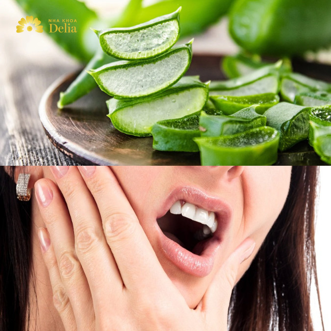 Cây thuốc chữa đau răng: cây nha đam