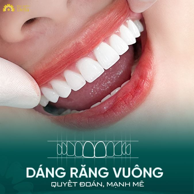 Dáng răng vuông