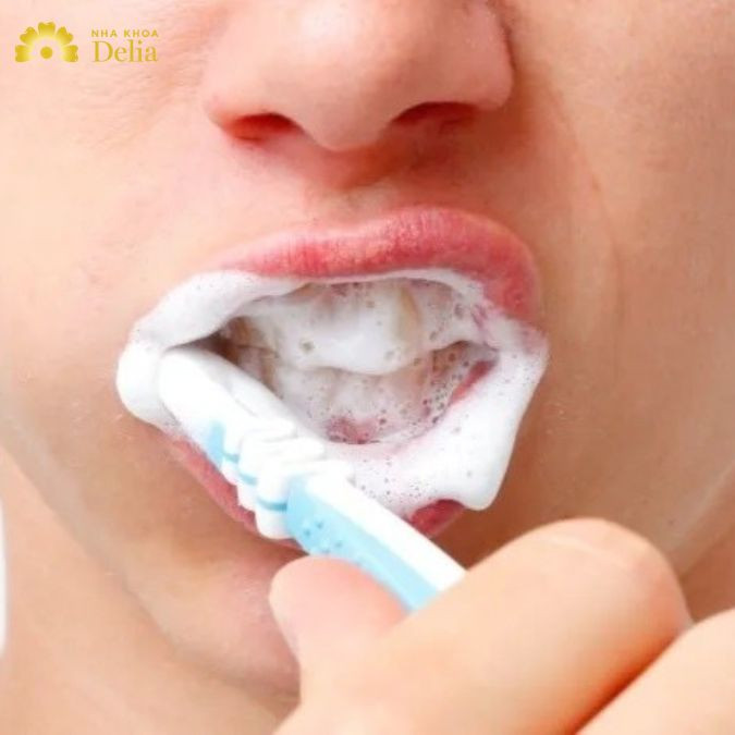 Chải răng sai kỹ thuật, sử dụng lực quá mạnh hoặc thời gian quá ngắn không thể loại bỏ hoàn toàn mảng bám