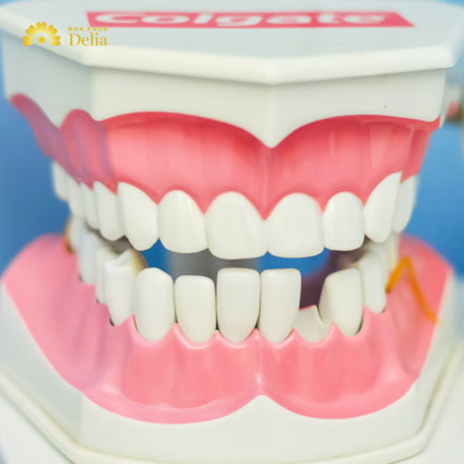 Hàm tháo lắp nhựa cứng là loại hàm giả với phần nền hàm được chế tác từ nhựa cứng