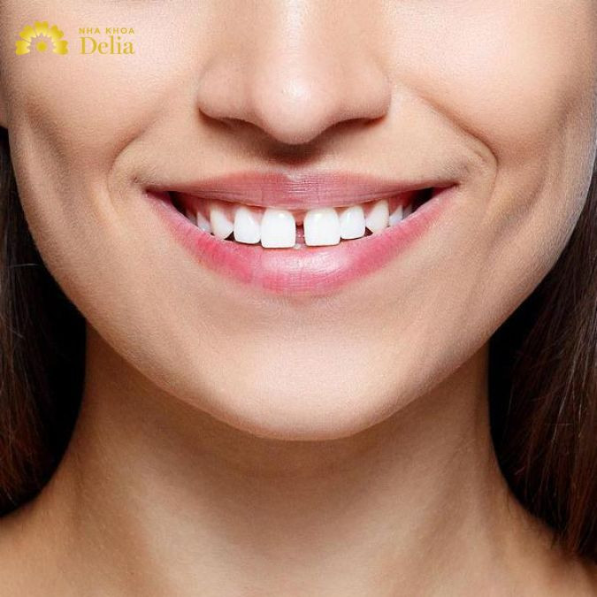 người phụ nữ răng chuột có hậu vận vô cùng hạnh phúc và may mắn