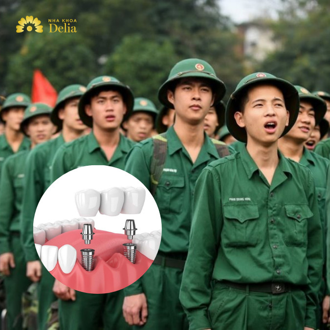 Răng giả có đi nghĩa vụ không? Răng giả nhưng vẫn đảm bảo trên 90% khả năng ăn nhai thì vẫn đi nghĩa vụ bình thường