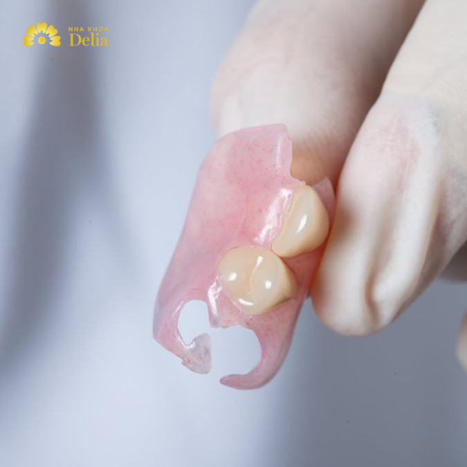 Giá răng giả tháo lắp một chiếc dao động trung bình ở mức 500.000 đ/răng.