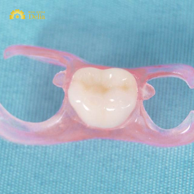 Răng giả tháo lắp 1 chiếc có thể dễ dàng tháo ra và lắp vào, giúp việc vệ sinh và bảo quản đơn giản hơn