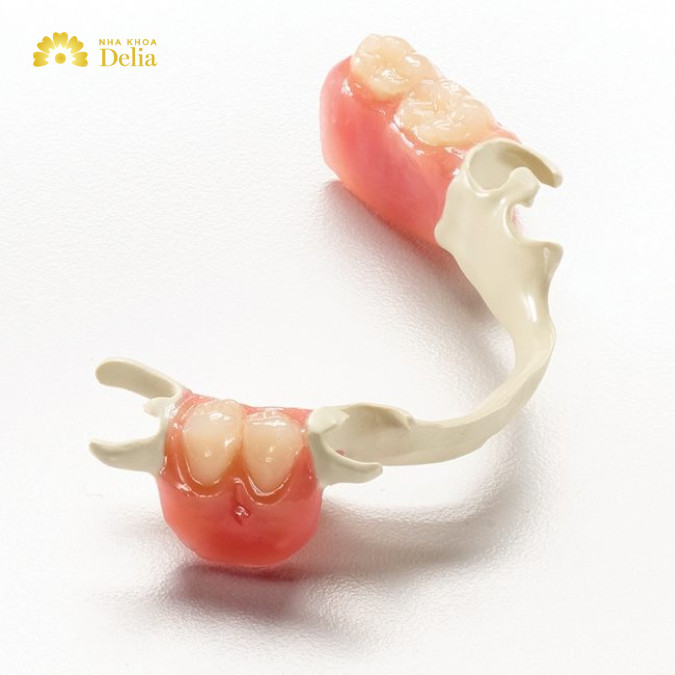 Răng giả có thể thường xuyên bị tuột ra, đặc biệt là khi ăn thức ăn có độ cứng cao.