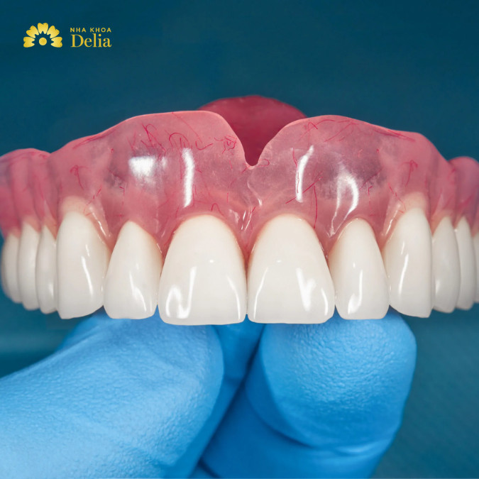RĂNG THÁO LẮP PHỤC HÌNH MẤT MỘT RĂNG