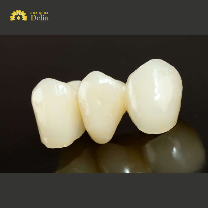 Mỗi loại cầu răng sứ sẽ có quy trình chế tác và thời gian hoàn thành khác nhau.