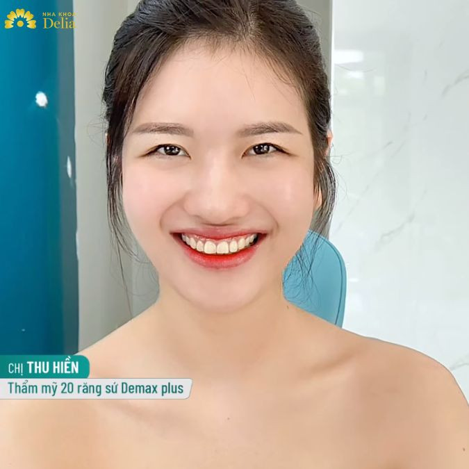 Răng khấp khểnh, đánh răng mãi không trắng là niềm trăn trở hàng ngày của chị Hiền