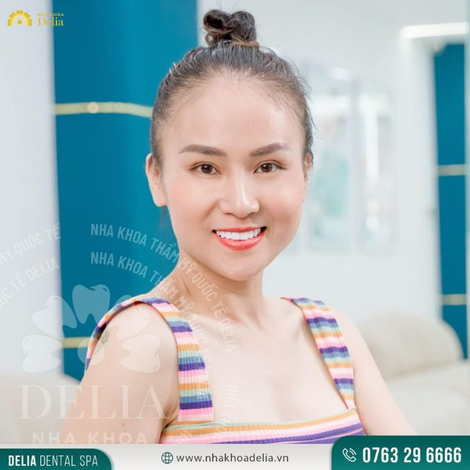 Đến Delia với tâm lý lo lắng, chị Hương đã trải qua 2 buổi làm răng nhẹ nhàng, không đau đớn