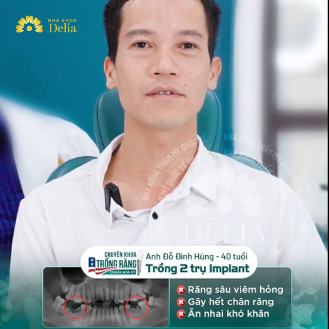 Anh Hùng gặp tình trạng răng sâu viêm nhiễm, gãy hết chân răng khiến việc ăn nhai khó khăn