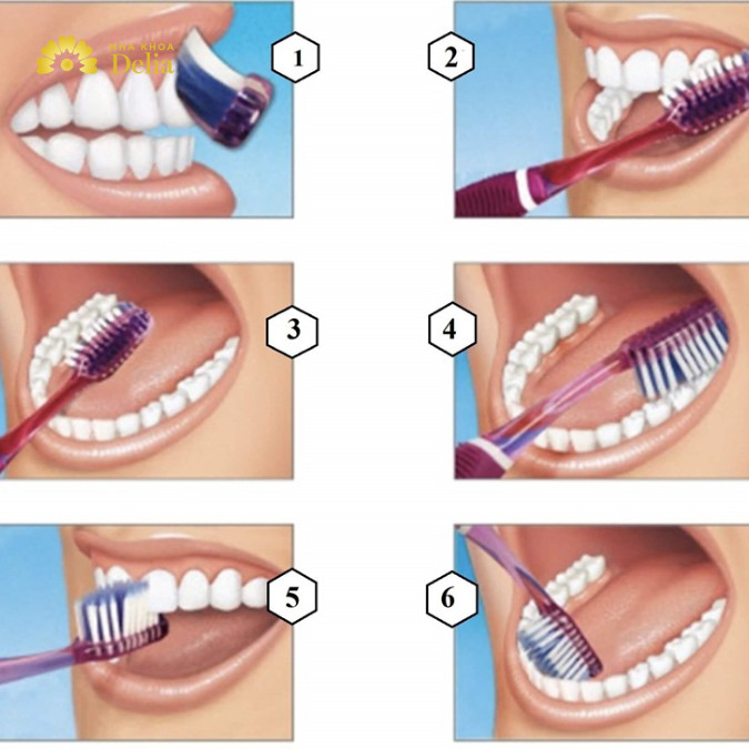 Vệ sinh răng miệng đúng cách với việc chải răng nhẹ nhàng 2 lần mỗi ngày giúp bảo vệ răng tối đa