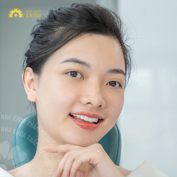 Sau khi lấy tủy, răng số 7 sẽ yếu, giòn và dễ gãy hơn, vì vậy cần bọc mão sứ hoặc trám răng để bảo vệ răng.