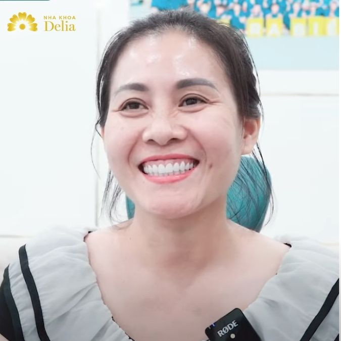Răng sứ HT Smile là dòng răng sứ cao cấp được sản xuất bởi tập đoàn HC Starck tại CHLB Đức