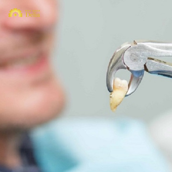 Nhổ răng sâu có cần trồng lại không?