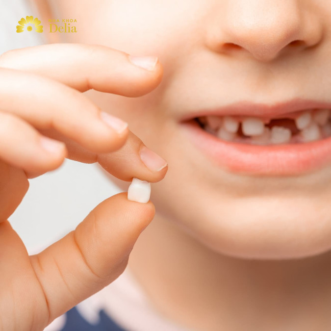 Nhổ răng sữa bị sâu vẫn có thể mọc lại răng vĩnh viễn