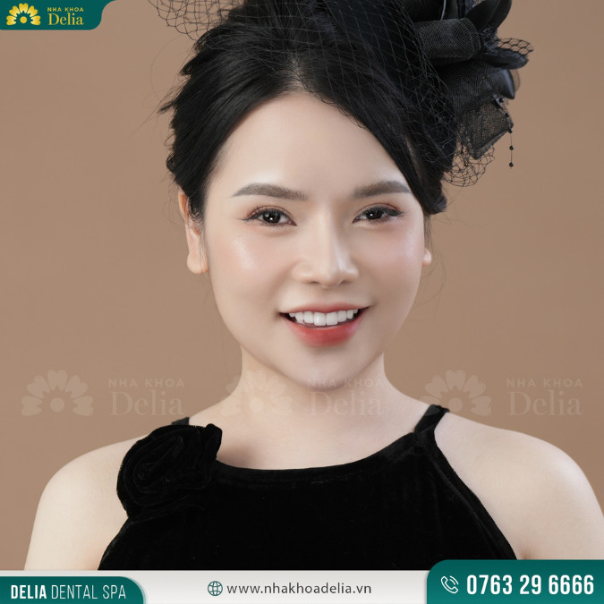 Tôi thực sự bất ngờ với sự chuyên nghiệp và nhẹ nhàng của các bác sĩ tại Nha khoa Delia - Chị Thủy Nguyễn chia sẻ