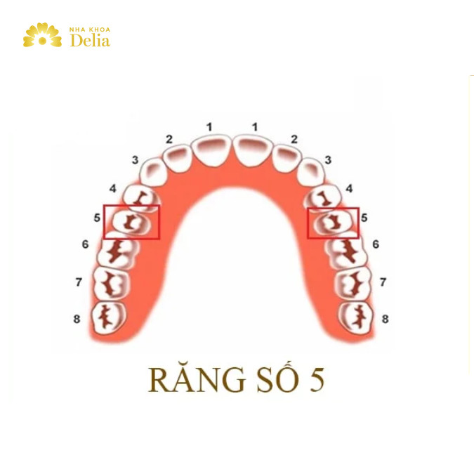 Nhổ răng số 5 khi răng này đang là răng vĩnh viễn thì sẽ không bao giờ mọc lại