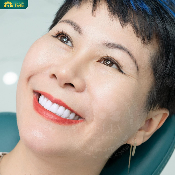 Tuổi thọ trung bình của răng sau khi lấy tủy thường nằm trong khoảng từ 10 đến 15 năm.