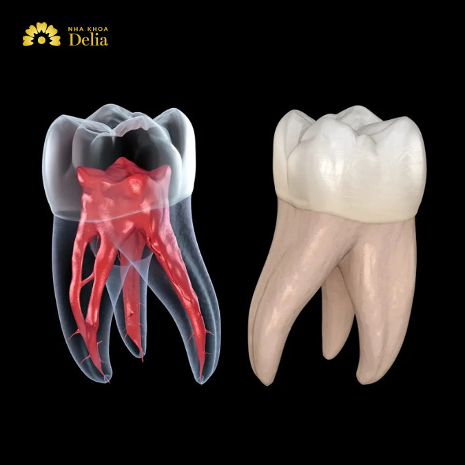 Răng số 6 thường có 2 - 3 chân răng và có 3 - 5 ống tủy, bao gồm 1 ống tủy lớn và các ống tủy phụ
