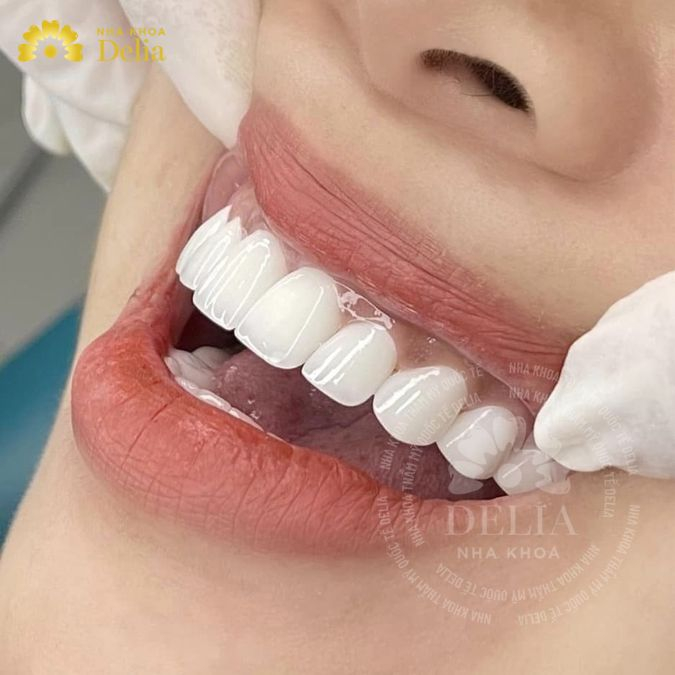 Thị trường nha khoa ở Canada cạnh tranh cao hơn so với Việt Nam
