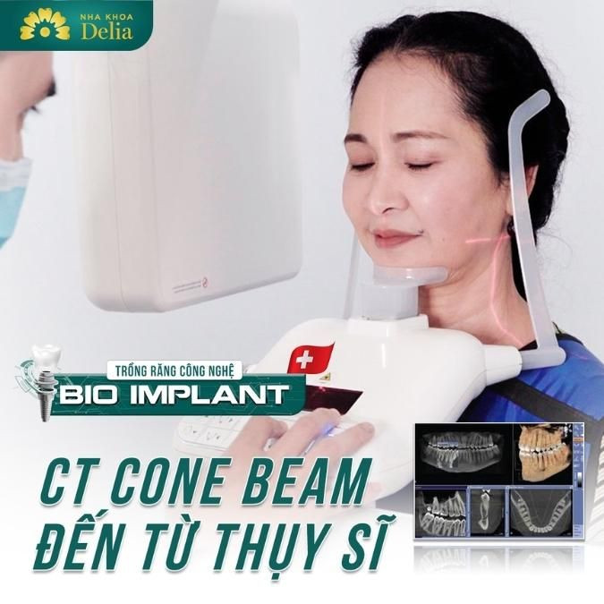 Nha khoa Delia không ngừng cập nhật công nghệ điều trị mới trong cấy ghép Implant