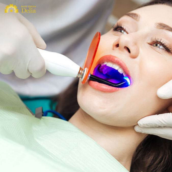 Càng ở vị trí đắc địa, trung tâm thành phố thì mức giá các dịch vụ tại nha khoa cũng sẽ cao hơn bao gồm cả tẩy trắng răng