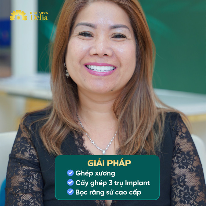 Chị Lisa Bùi tự tin với hàm răng mới sau khi cấy ghép Implant với trụ Hiossen Mỹ