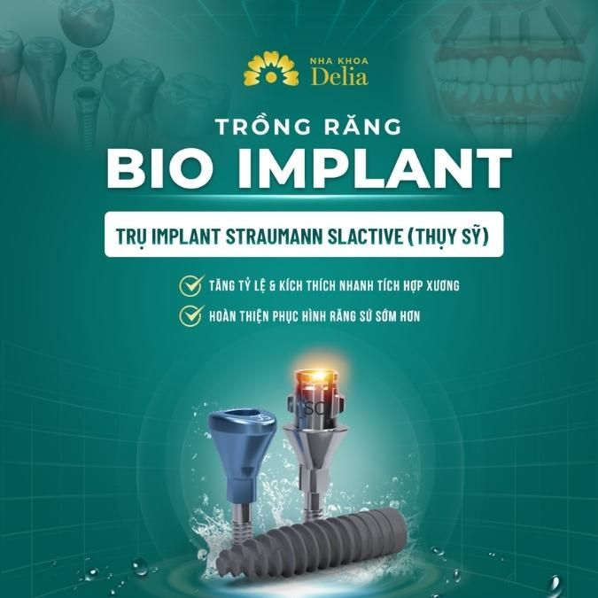 Trụ Straumann SLA từ Thụy Sĩ được đánh giá cao cho các ca cấy ghép toàn hàm