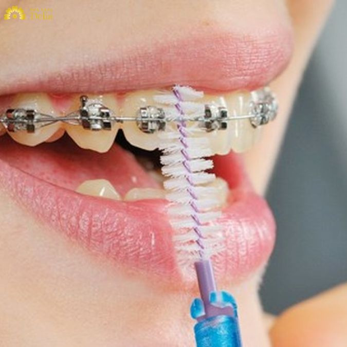 bạn cần sử dụng các dụng cụ chuyên dụng phù hợp