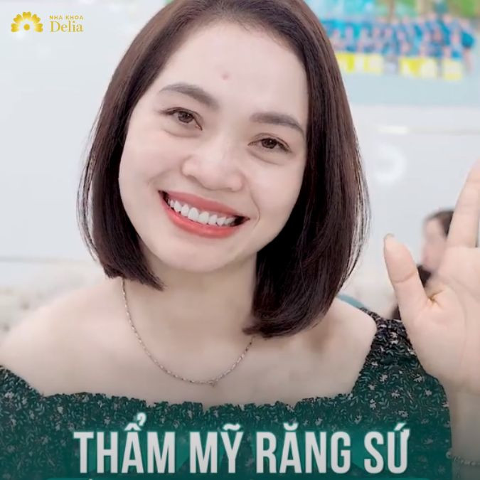 Sau khi được bác sĩ tư vấn chị Hương quyết định thẩm mỹ 18 răng sứ Emax