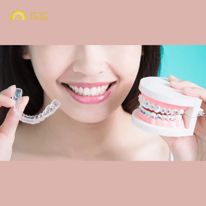 Việc lựa chọn phương pháp niềng răng tốt nhất phụ thuộc vào nhiều yếu tố như mục tiêu thẩm mỹ, tình trạng răng miệng cụ thể và ngân sách của bạn. 
