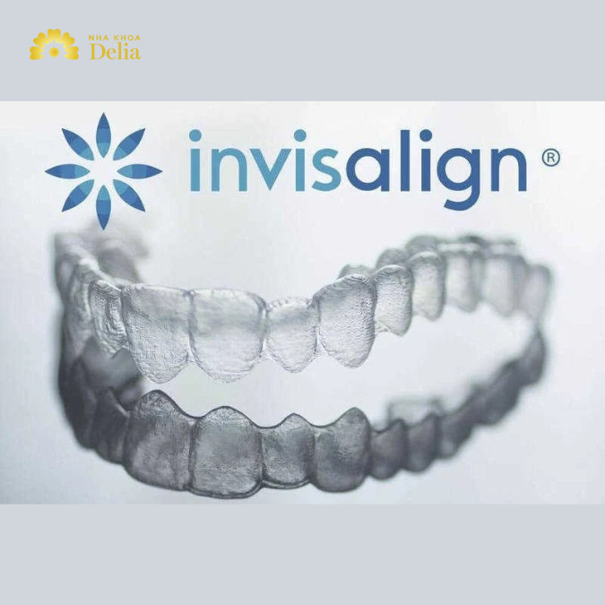 Niềng răng Invisalign là gì? Tất tần tật thông tin từ A - Z