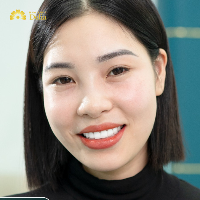 Invisalign không chỉ vượt trội về mặt thẩm mỹ mà còn rất hiệu quả trong việc điều chỉnh các vấn đề về răng và khớp cắn