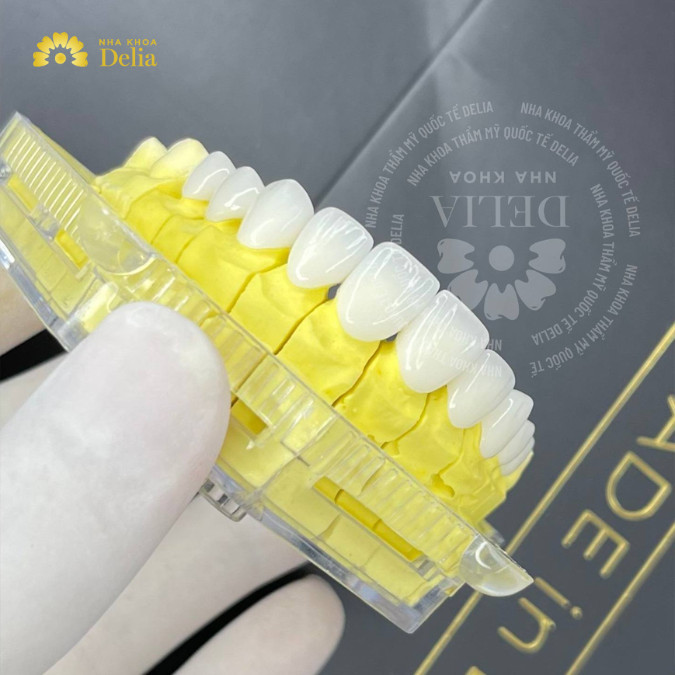 Với sự hỗ trợ của công nghệ 3D tiên tiến, khay niềng trong suốt được thiết kế để phù hợp hoàn hảo với cấu trúc răng của từng người.