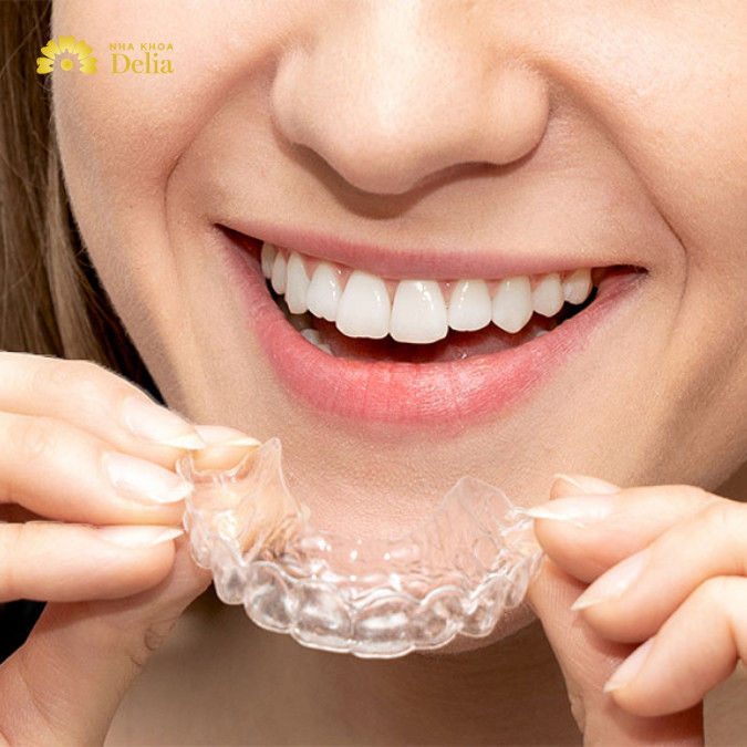 Niềng răng trong suốt là một phương pháp chỉnh nha hiện đại sử dụng các khay niềng nhựa trong, mềm mại và có thể tháo rời khi cần thiết