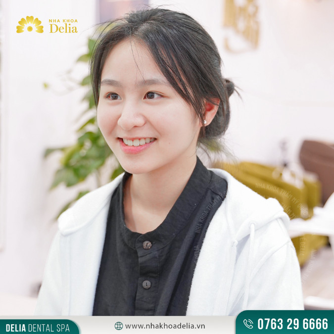 Em Thu Quỳnh cho biết niềng răng trong suốt chỉ đau giai đoạn đầu thay khay niềng, về sau em cảm thấy thoải mái hơn