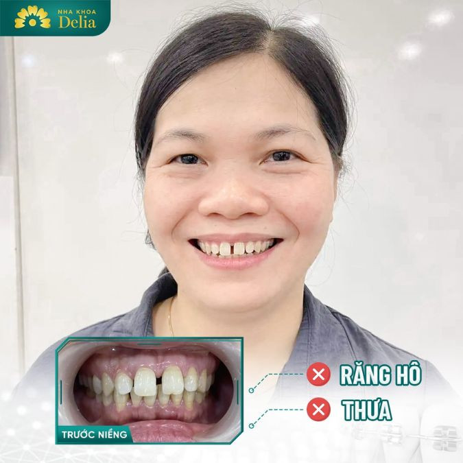 Chị Thu, nhân viên văn phòng