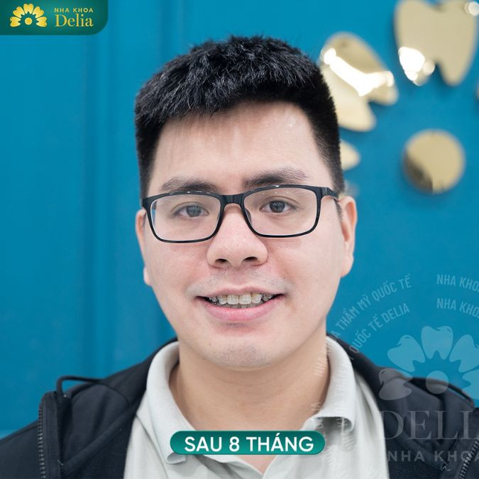 Anh Tuấn - Nhân viên văn phòng