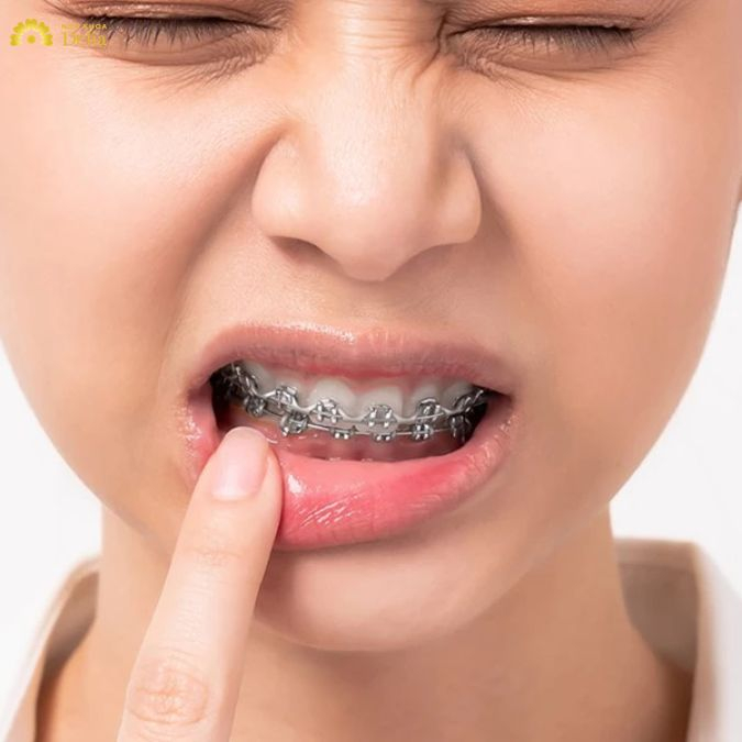 Việc thăm khám răng định kỳ theo đúng lịch hẹn sẽ giúp bác sĩ theo dõi quá trình điều trị, kịp thời phát hiện và xử lý các vấn đề phát sinh