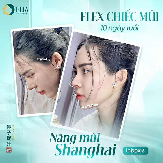Công nghệ tạo dáng mắt, dáng mũi Shanghai Unique từ Trung Quốc
