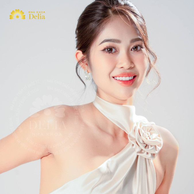 Trồng răng Implant tại Nha Khoa Delia là một trải nghiệm tuyệt vời. Từ tư vấn đến điều trị, mọi thứ đều rất chu đáo và chuyên nghiệp