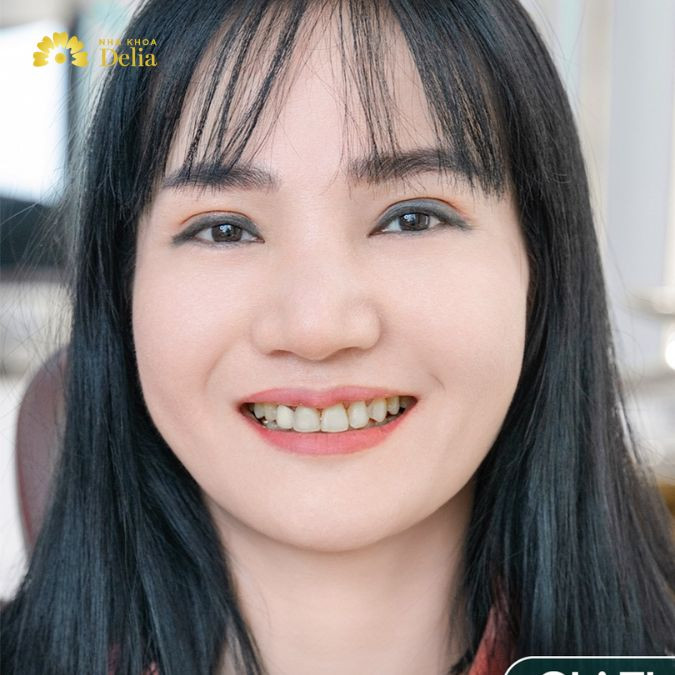 Quá trình điều trị diễn ra nhanh chóng, không làm ảnh hưởng đến lịch trình bận rộn của tôi