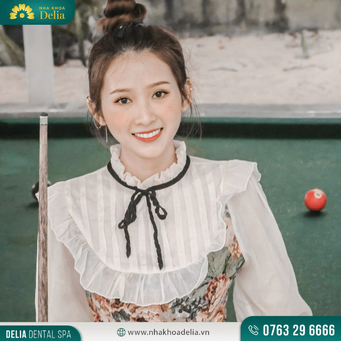 Quá trình niềng răng hàm trên diễn ra suôn sẻ, không có bất kỳ trở ngại nào và kết quả cuối cùng vượt trên mong đợi của tôi - Chị Thanh Trà