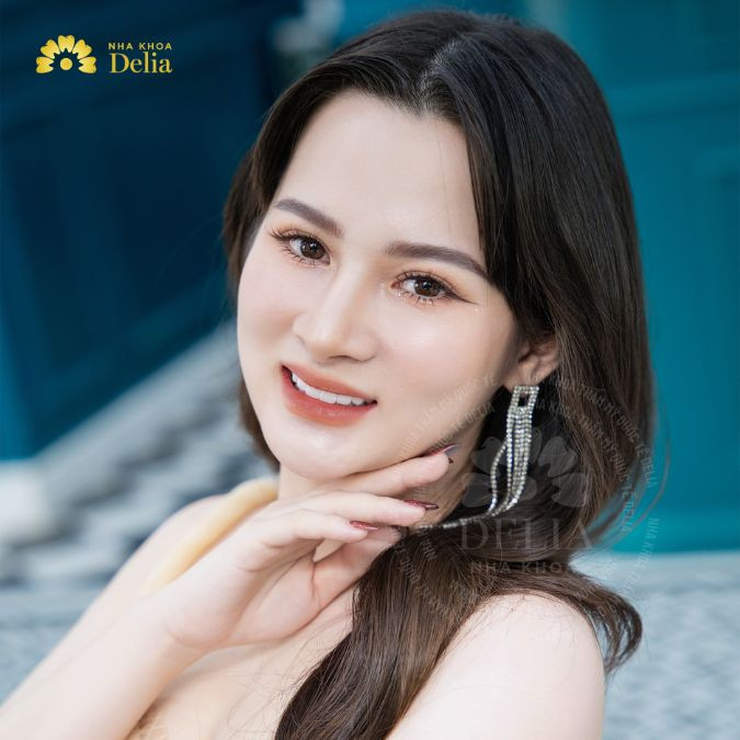 Tôi đã quyết định nhổ bốn chiếc răng khôn trước khi niềng răng tại Delia