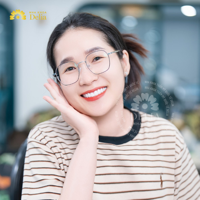Dịch vụ tại Delia rất tuyệt vời và tôi cực kỳ hài lòng với nụ cười mới của mình - Chị Nguyên