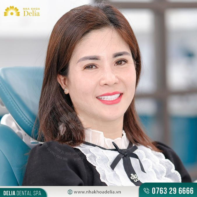 Chị Thu Hà - Thẩm mỹ 20 răng sứ Emax