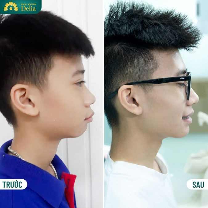 Bạn Nam - Học sinh cấp 3